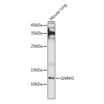 Western Blot - Anti-GnRH Antibody (A9729) - Antibodies.com