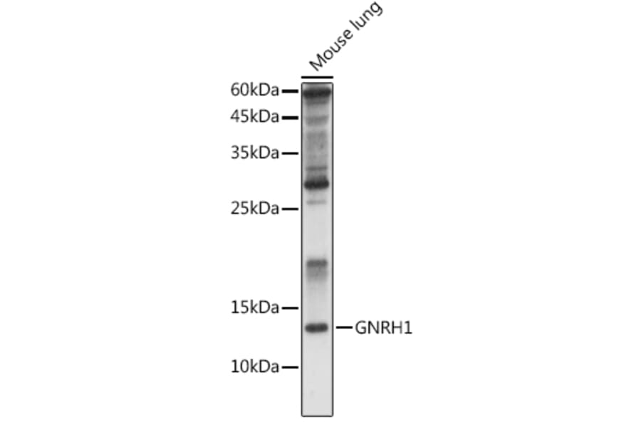 Western Blot - Anti-GnRH Antibody (A9729) - Antibodies.com