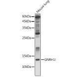 Western Blot - Anti-GnRH Antibody (A9729) - Antibodies.com