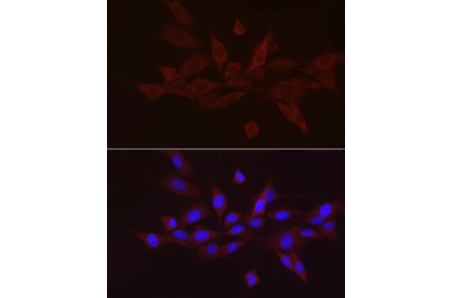 Immunofluorescence - Anti-GnRH Antibody (A9729) - Antibodies.com