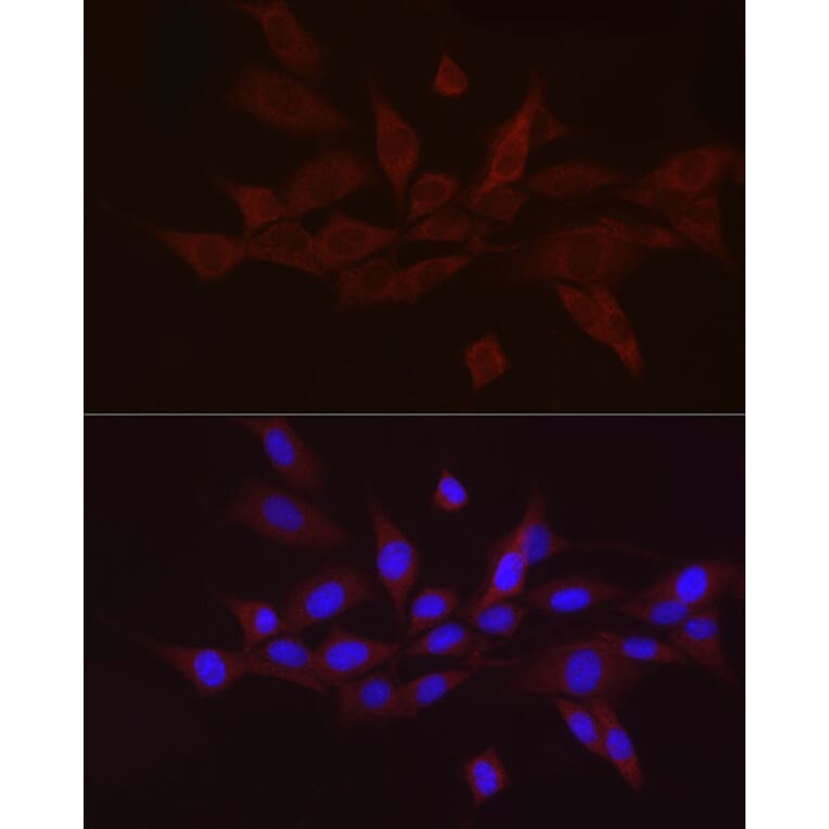 Immunofluorescence - Anti-GnRH Antibody (A9729) - Antibodies.com