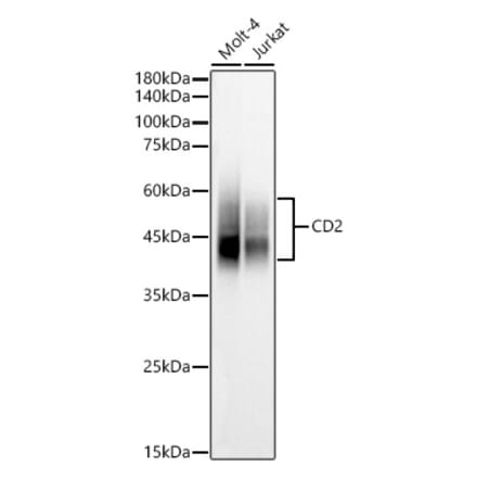 Western Blot - Anti-CD2 Antibody (A9731) - Antibodies.com