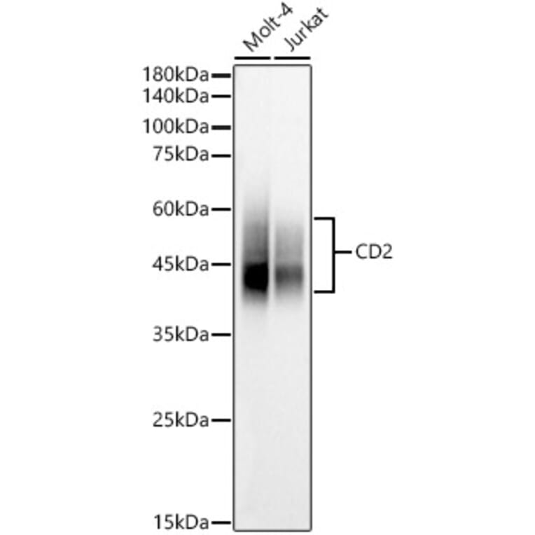 Western Blot - Anti-CD2 Antibody (A9731) - Antibodies.com