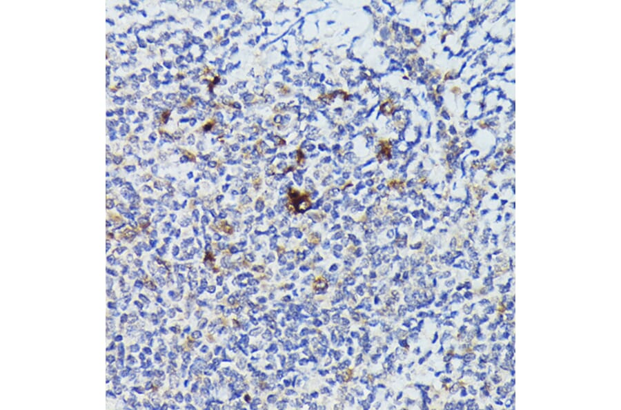 Immunohistochemistry - Anti-Cathepsin G Antibody (A9732) - Antibodies.com