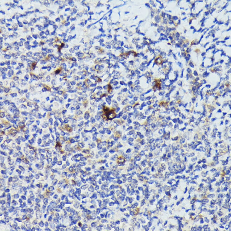 Immunohistochemistry - Anti-Cathepsin G Antibody (A9732) - Antibodies.com