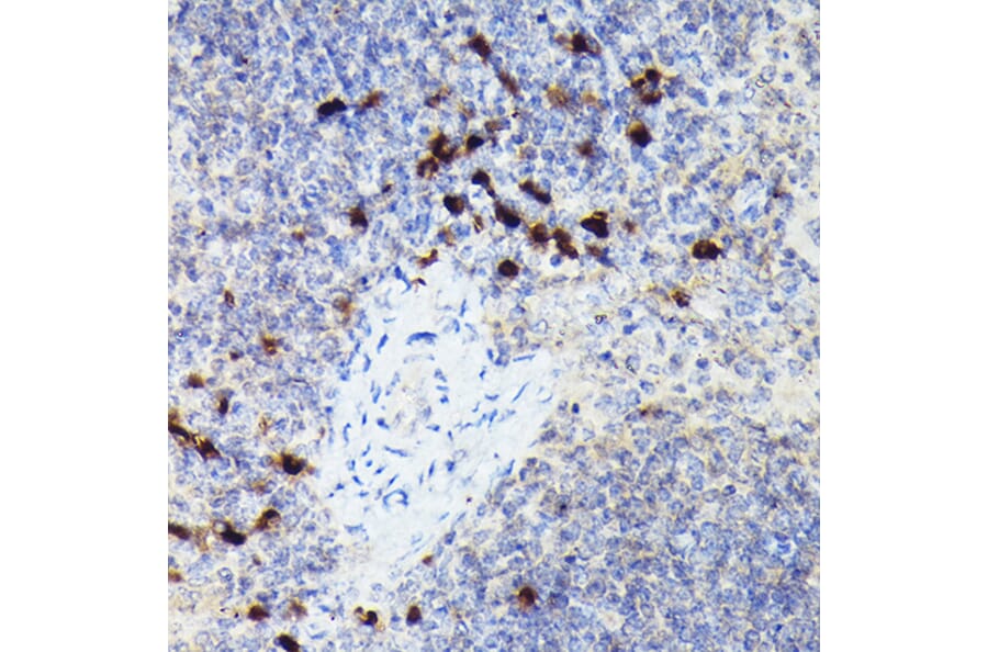 Immunohistochemistry - Anti-Cathepsin G Antibody (A9732) - Antibodies.com