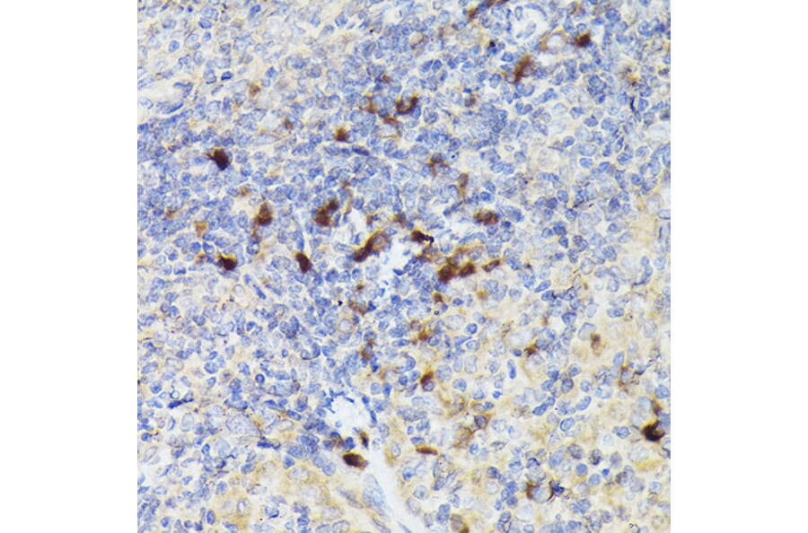 Immunohistochemistry - Anti-Cathepsin G Antibody (A9732) - Antibodies.com