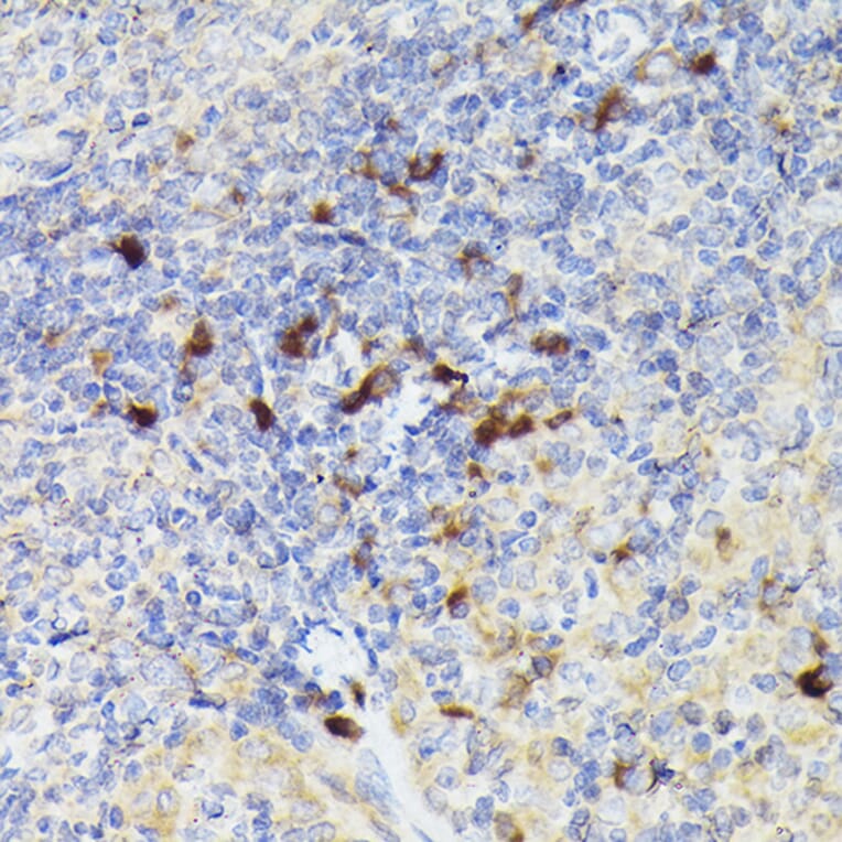 Immunohistochemistry - Anti-Cathepsin G Antibody (A9732) - Antibodies.com