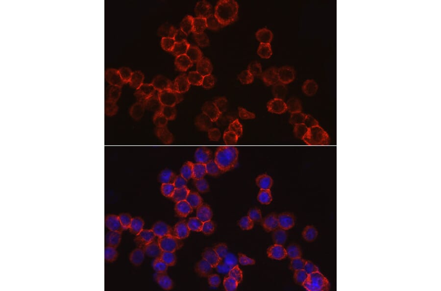 Immunofluorescence - Anti-Cathepsin G Antibody (A9732) - Antibodies.com