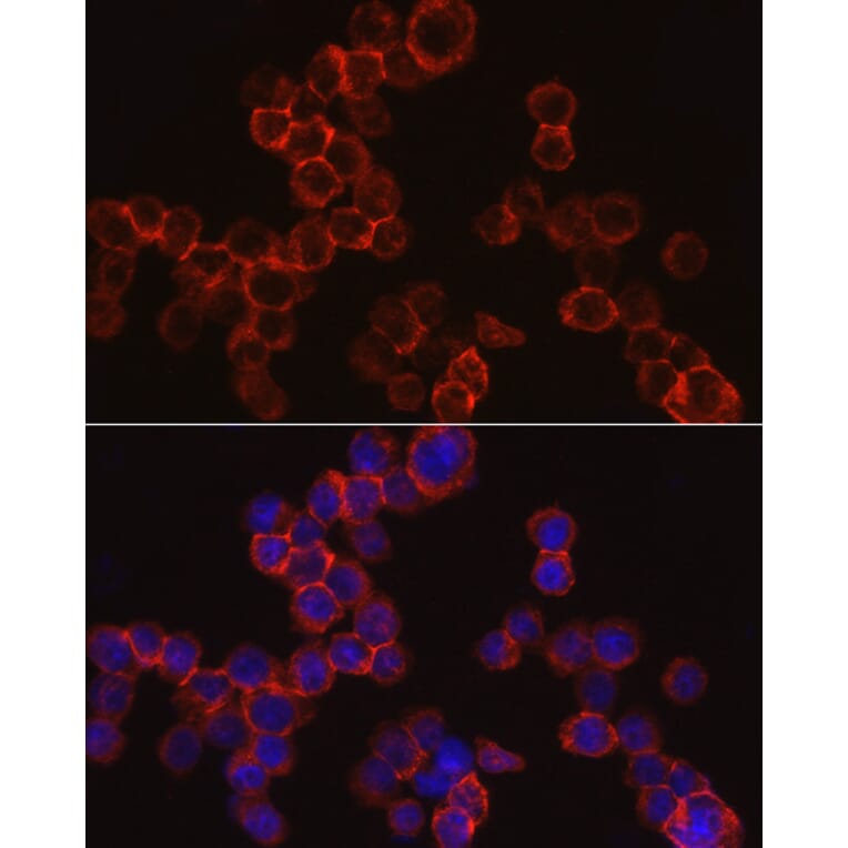 Immunofluorescence - Anti-Cathepsin G Antibody (A9732) - Antibodies.com