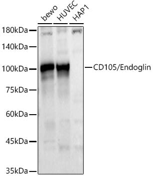 Western blot analysis of extracts of various cell lines, using Anti-ENG Antibody (A5639) at 1:1,000 dilution. Secondary antibody: Goat Anti-Rabbit IgG (H+L) (HRP) (AS014) at 1:10,000 dilution. Lysates / proteins: 25µg per lane. Blocking buffer: 3% non-fat dry milk in TBST. Detection: ECL Enhanced Kit (RM00021). Exposure time: 30s.