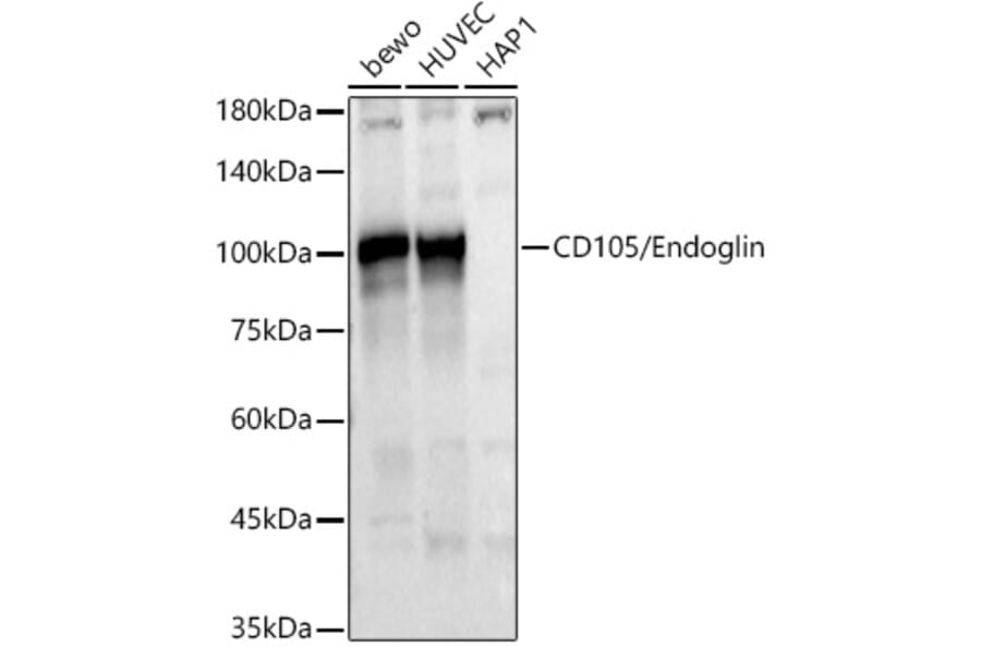 Western Blot - Anti-CD105 Antibody (A9733) - Antibodies.com