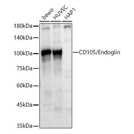 Western Blot - Anti-CD105 Antibody (A9733) - Antibodies.com