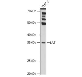 Western Blot - Anti-LAT Antibody (A9734) - Antibodies.com