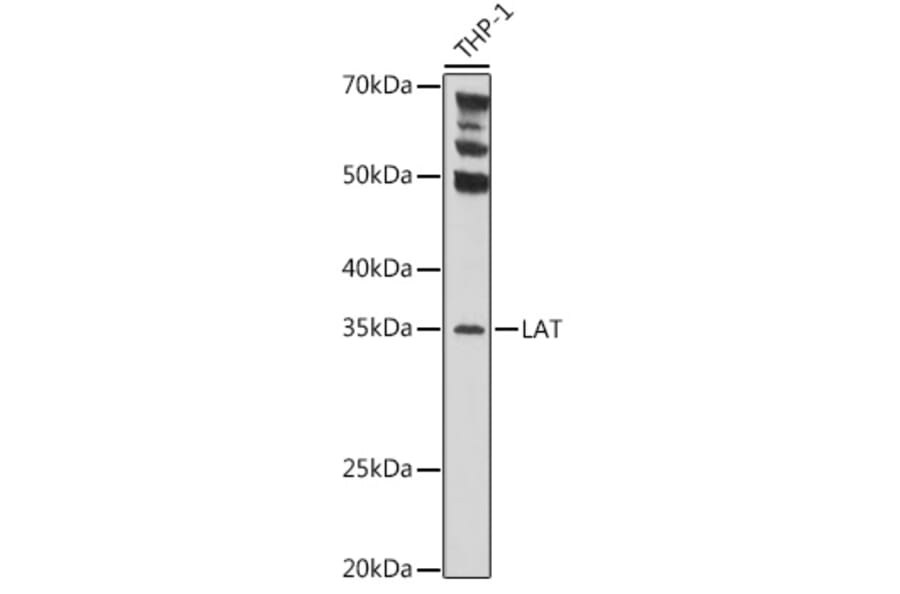 Western Blot - Anti-LAT Antibody (A9734) - Antibodies.com