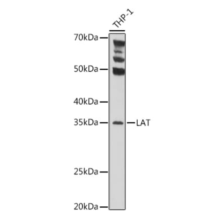 Western Blot - Anti-LAT Antibody (A9734) - Antibodies.com