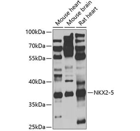 Western Blot - Anti-Nkx2.5 Antibody (A9735) - Antibodies.com
