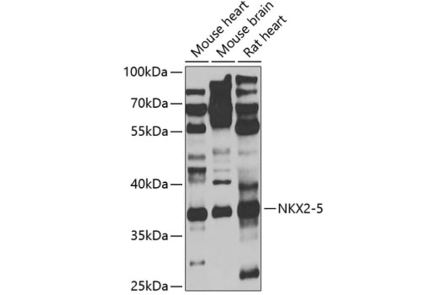 Western Blot - Anti-Nkx2.5 Antibody (A9735) - Antibodies.com