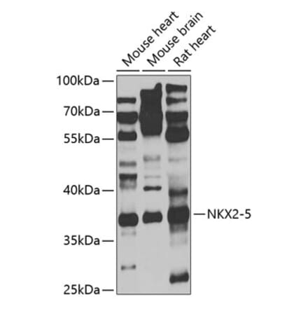 Western Blot - Anti-Nkx2.5 Antibody (A9735) - Antibodies.com