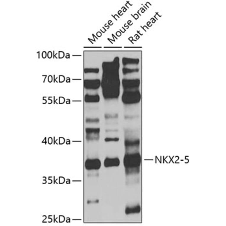 Western Blot - Anti-Nkx2.5 Antibody (A9735) - Antibodies.com