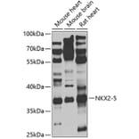 Western Blot - Anti-Nkx2.5 Antibody (A9735) - Antibodies.com