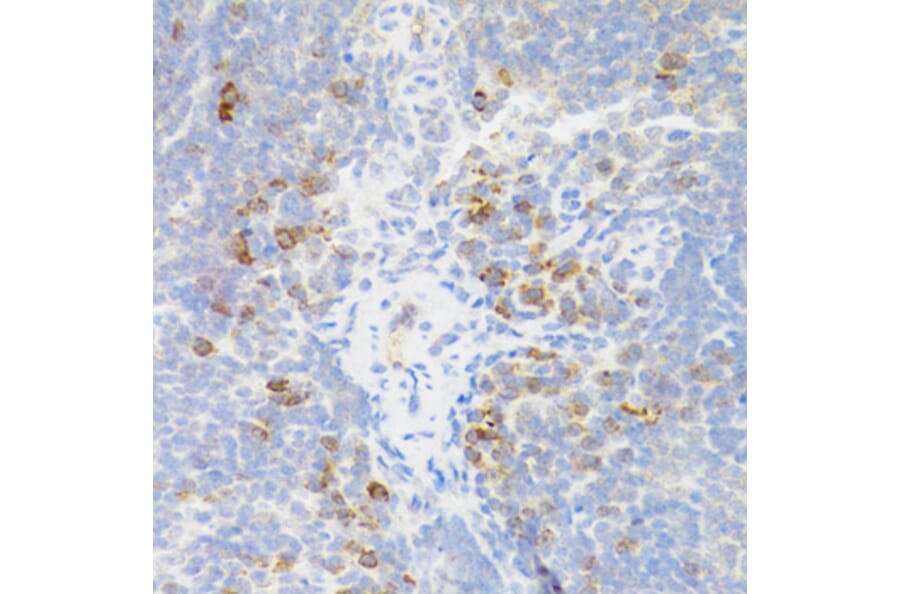 Immunohistochemistry - Anti-TNFRSF13B Antibody (A5658) - Antibodies.com