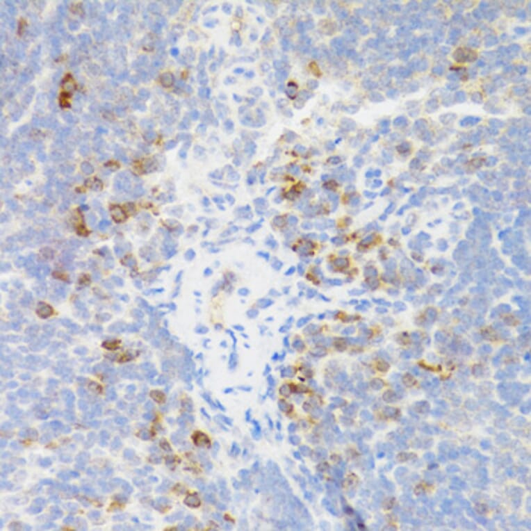 Immunohistochemistry - Anti-TNFRSF13B Antibody (A5658) - Antibodies.com