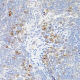Immunohistochemistry - Anti-TNFRSF13B Antibody (A5658) - Antibodies.com