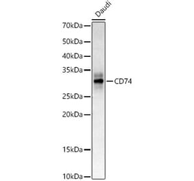Western Blot - Anti-CD74 Antibody (A9737) - Antibodies.com
