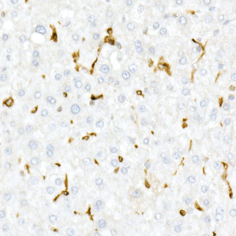 Immunohistochemistry - Anti-CD74 Antibody (A9737) - Antibodies.com