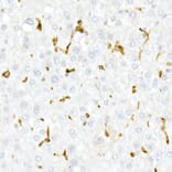 Immunohistochemistry - Anti-CD74 Antibody (A9737) - Antibodies.com