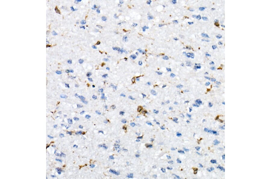 Immunohistochemistry - Anti-CD74 Antibody (A9737) - Antibodies.com