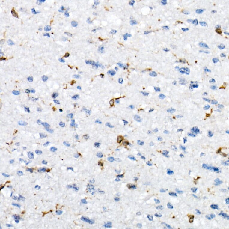 Immunohistochemistry - Anti-CD74 Antibody (A9737) - Antibodies.com