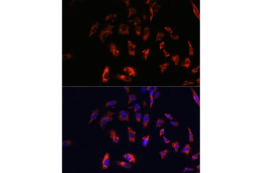 Immunofluorescence - Anti-CD74 Antibody (A9737) - Antibodies.com
