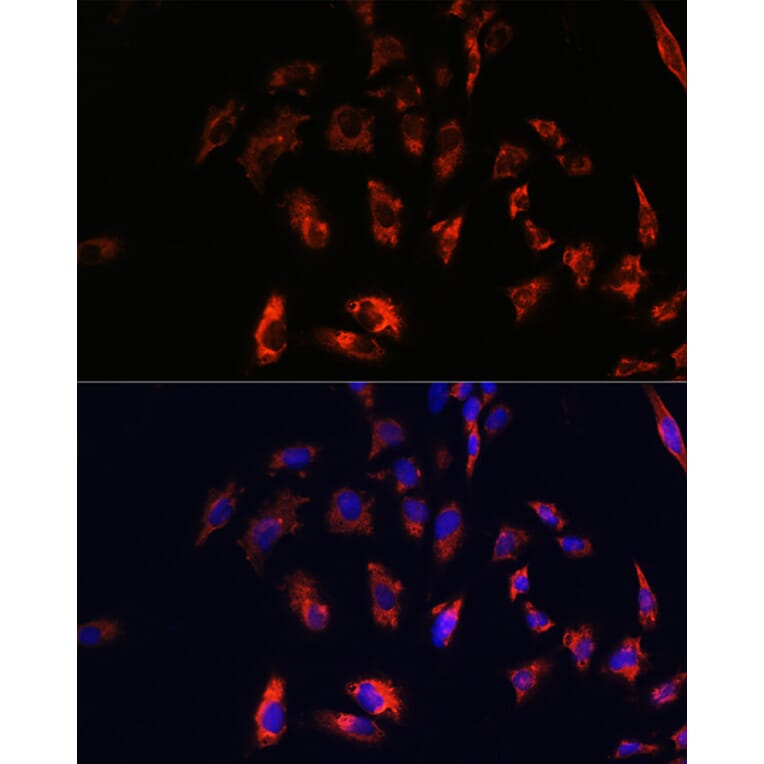 Immunofluorescence - Anti-CD74 Antibody (A9737) - Antibodies.com