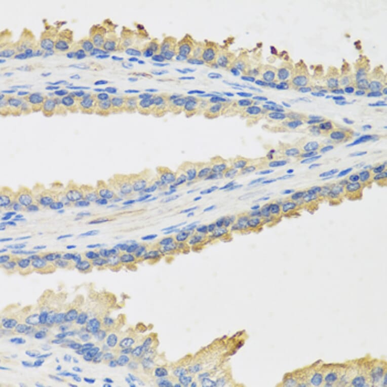 Immunohistochemistry - Anti-Leptin Antibody (A9738) - Antibodies.com