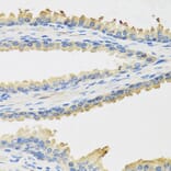 Immunohistochemistry - Anti-Leptin Antibody (A9738) - Antibodies.com