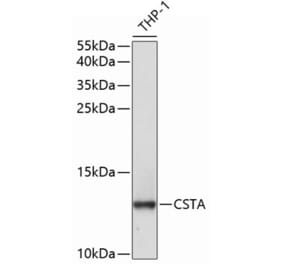 Western Blot - Anti-Cystatin A Antibody (A9740) - Antibodies.com