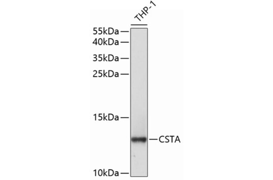 Western Blot - Anti-Cystatin A Antibody (A9740) - Antibodies.com