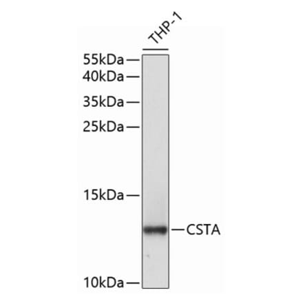 Western Blot - Anti-Cystatin A Antibody (A9740) - Antibodies.com