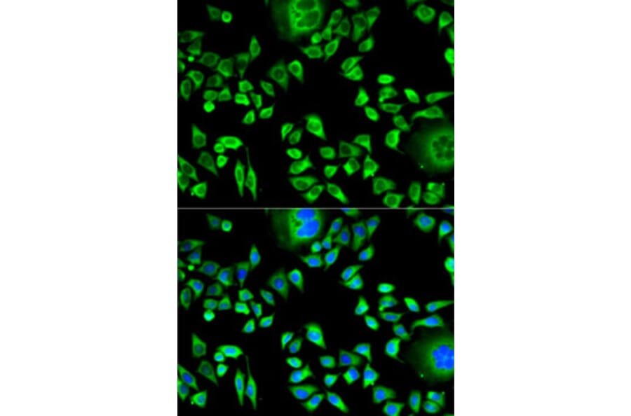 Immunofluorescence - Anti-Cystatin A Antibody (A9740) - Antibodies.com