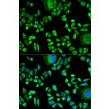 Immunofluorescence - Anti-Cystatin A Antibody (A9740) - Antibodies.com
