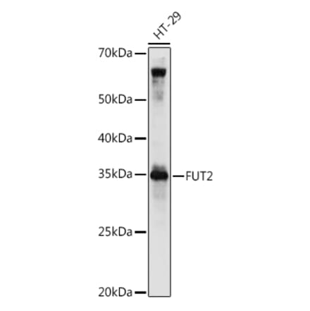 Western Blot - Anti-FUT2 Antibody (A9742) - Antibodies.com