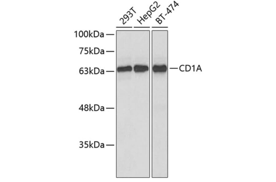 Western Blot - Anti-CD1a Antibody (A9743) - Antibodies.com