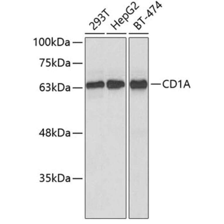 Western Blot - Anti-CD1a Antibody (A9743) - Antibodies.com