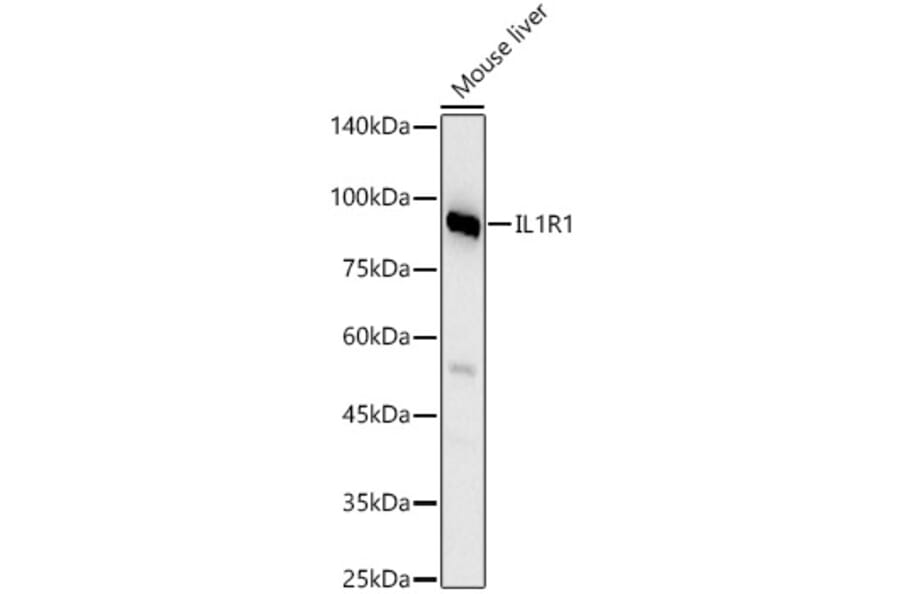 Western Blot - Anti-IL1 Receptor I/IL-1R-1 Antibody (A9744) - Antibodies.com