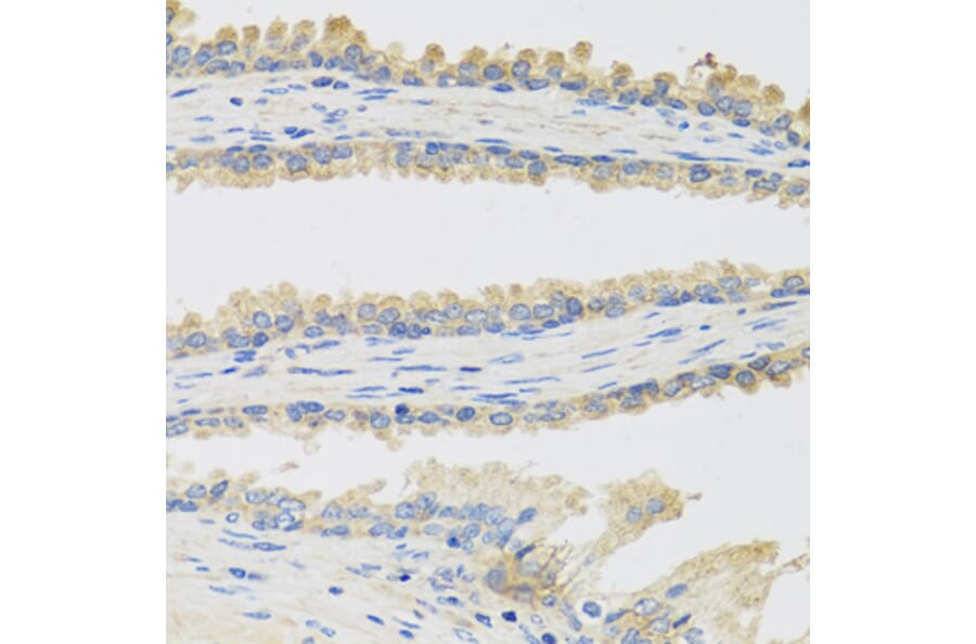 Immunohistochemistry - Anti-INSL3 Antibody (A9745) - Antibodies.com