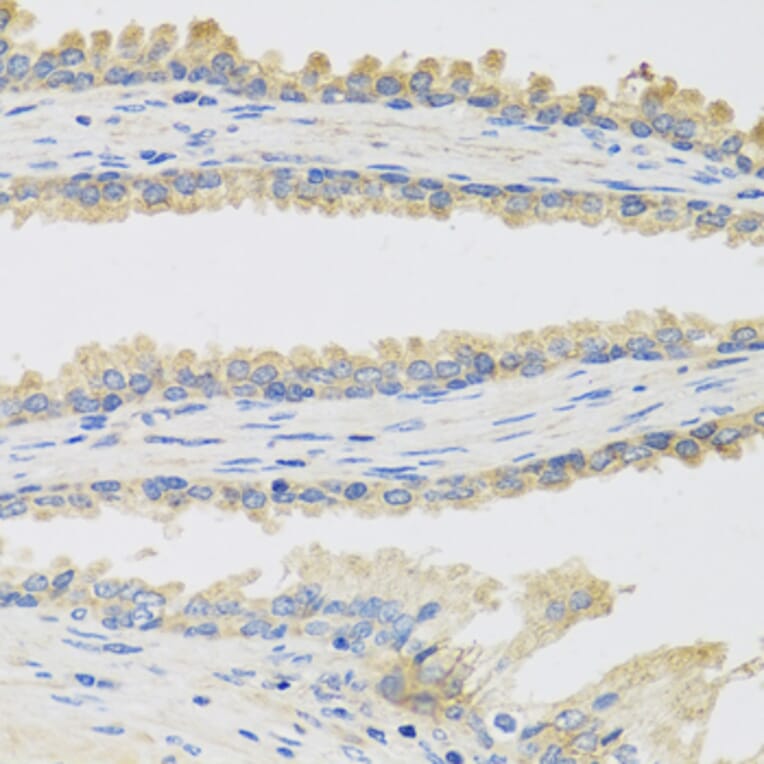Immunohistochemistry - Anti-INSL3 Antibody (A9745) - Antibodies.com