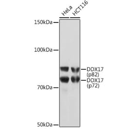 Western Blot - Anti-DDX17 Antibody [ARC1413] (A9746) - Antibodies.com