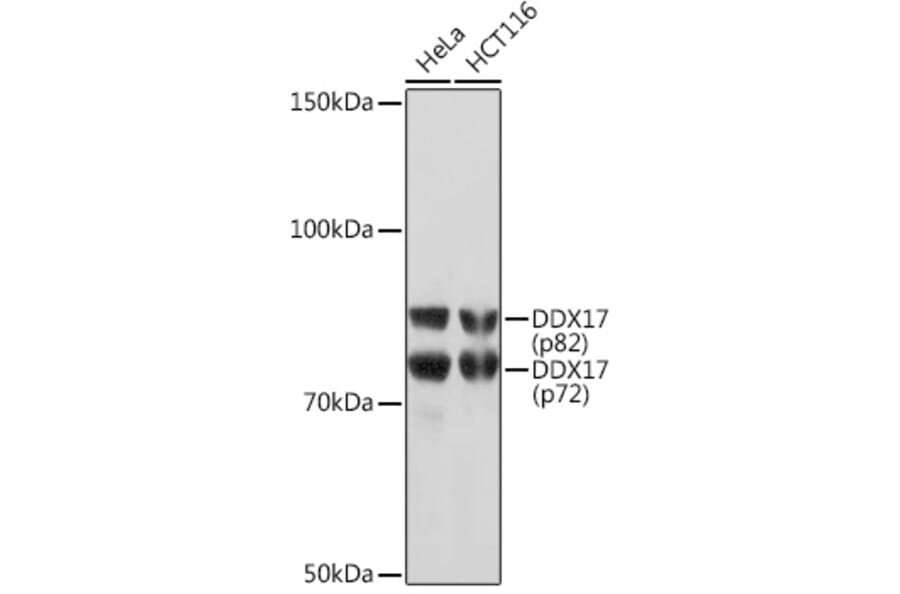 Western Blot - Anti-DDX17 Antibody [ARC1413] (A9746) - Antibodies.com